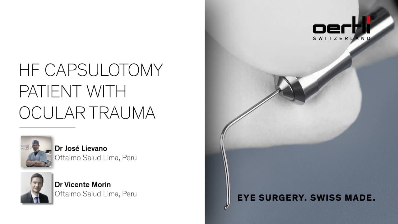 Surgery Video: HF Capsulotomy on patient with ocular trauma | José Lievano & Vicente Morín
