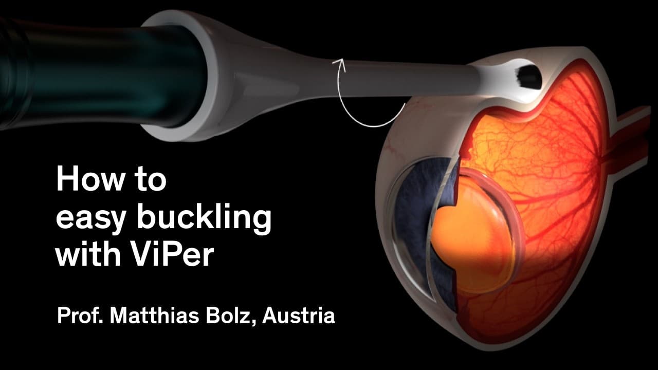 Spotlight: Easy buckling with ViPer
