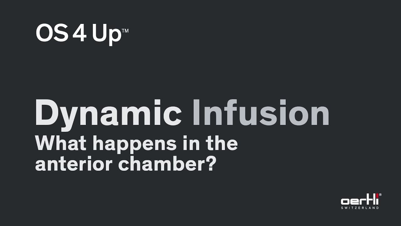 What happens in the anterior chamber | Dynamic Infusion | OS 4 Up | Dr Nicola Vandemeulebroecke